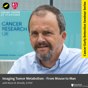CEDSS Seminar: Imaging Tumor Metabolism – From Mouse to Man @ Zoom - See Description for Zoom Link
